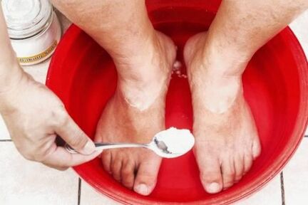 Behandeling van de schimmel op de duim van het been