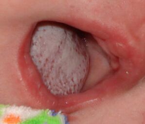 Lokalisatie van de ziekte met een schimmel