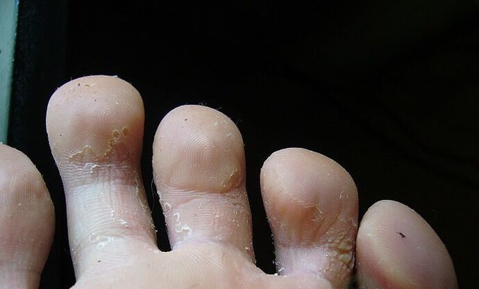 beginstadium van schimmel